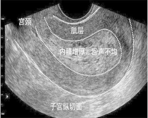 不孕不育征兆