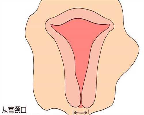 查不育