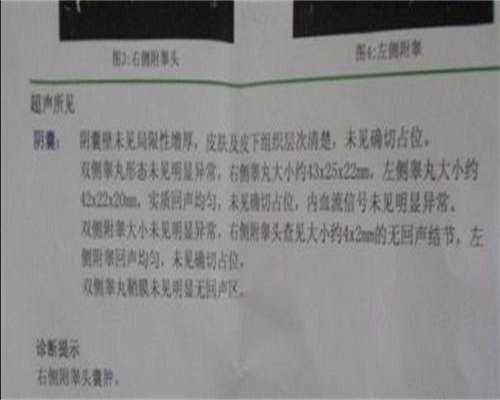 免疫性不孕