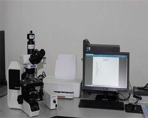 抗绒毛膜促性腺激素抗体不孕