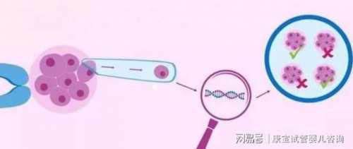 双角子宫试管